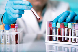 La Hematología en Cuba, centrada en la calidad de vida