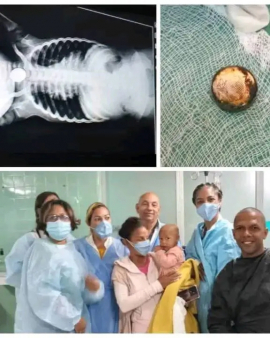 Extraen con éxito cuerpo extraño ingerido por infante santiaguera