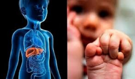 Hepatitis Infantil Aguda: Cuba sin casos, pero en constante vigilancia