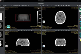 Plataforma Imagis moderniza servicios de Radiología en el oriente de Cuba