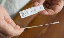 Francia sin medidas particulares por nueva variante del SARS-CoV-2